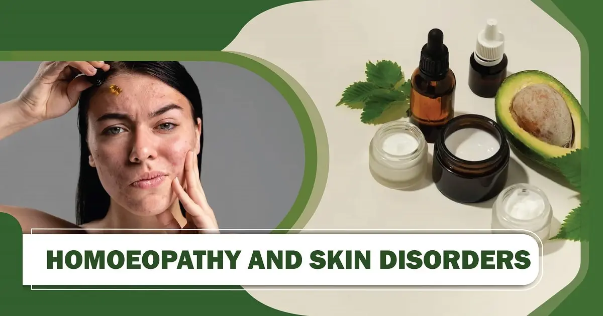 Homeopathic Skin Treatments